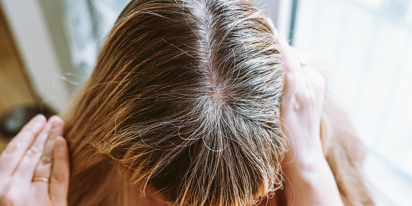 Winter-Haarausfall & Kopfhautberuhigung